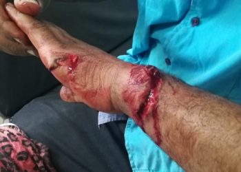 اعتداء خطير بسيف على شخص بالغرب