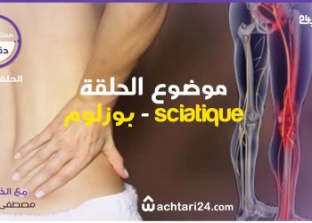 صحتك في دقائق – ماهو بوزلوم وأسبابه ؟؟