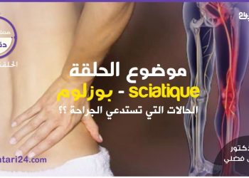 الحلقة الرابعة : مرض بوزلوم – الحالات التي تستدعي الجراحة