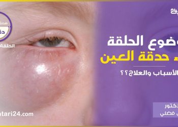 صحتك في دقائق : مرض نتوء حدقة العين الأسباب والعلاج