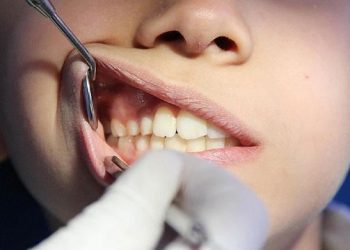 تراجع صحة الفم يقود للتدهور المعرفي وضعف الذاكرة 