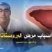 البروستاتا : أسباب سرطان البروستات