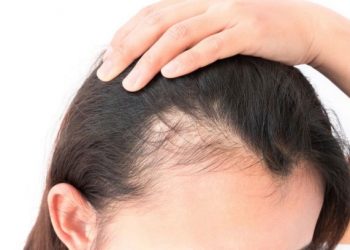 خلطات لتكثيف الشعر ومنع تساقطه