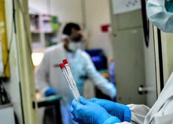 132 حالة بالخميسات في 48 ساعة بسبب بؤرتين في معامل بتيفلت