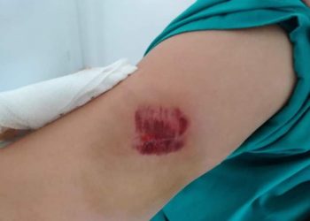 اعتداء على “قابلة” بالسب والضرب من طرف سيدة بسبب “الكمامة” ضواحي طنجة