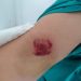 اعتداء على “قابلة” بالسب والضرب من طرف سيدة بسبب “الكمامة” ضواحي طنجة