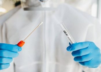 اعتماد تعريفة جديدة لاختبارات الكشف عن “كوفيد 19”