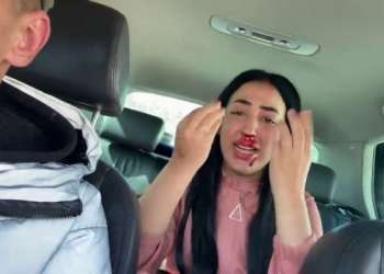 “ندى حاسي” تتعرض للاعتداء بأكادير