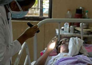 الطبيب “حمضي” يوضح خطورة مرض الفطر الأسود
