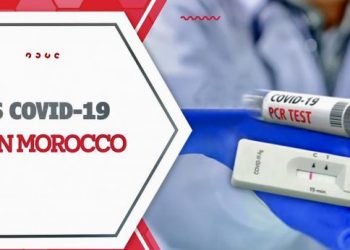 اطلاق وحدة صناعية لإنتاج اختبارات كوفيد-19 “صنع في المغرب” من قبل جيغالاب