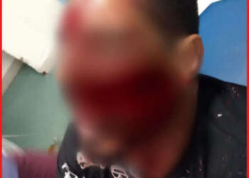 اعتقال ذو سوابق بفاس شرمل ضحيته