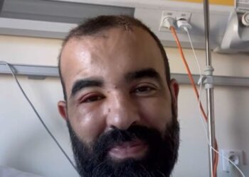 اعتداء على الفنان الشفشاوني حميد الحضري من قبل أحد الأشخاص أمام باب فندقه