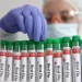 الولايات المتحدة تسجل أول وفاة بشرية بسبب إنفلونزا الطيور