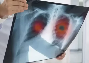 مراكش تحتضن مؤتمراً دولياً حول أمراض الجهاز التنفسي بمشاركة نخبة من الخبراء