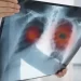 مراكش تحتضن مؤتمراً دولياً حول أمراض الجهاز التنفسي بمشاركة نخبة من الخبراء