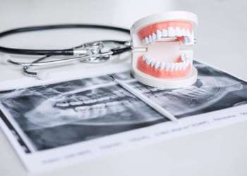 هيئة أطباء الأسنان تحذر من تنامي الممارسات غير القانونية لمهنة طب الأسنان