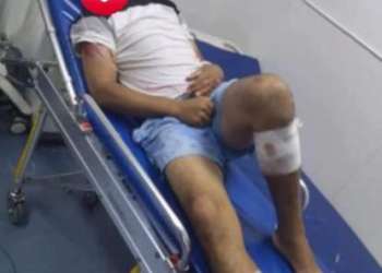 ألعاب متهالكة وقديمة تهدد سلامة الزوار بمرتيل