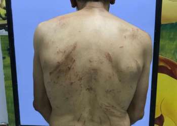 شفشاون.. سائق طاكسي صغير وصديقه يعتديان على مواطن بسبب نقاش بسيط