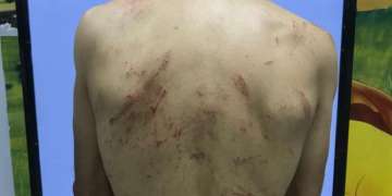 شفشاون.. سائق طاكسي صغير وصديقه يعتديان على مواطن بسبب نقاش بسيط